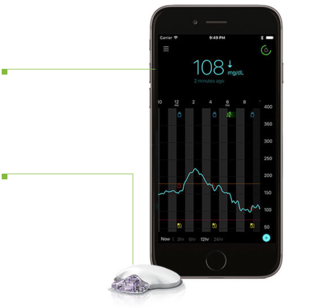 Guardian Connect CGM System 30 Day Trial Medtronic Diabetes